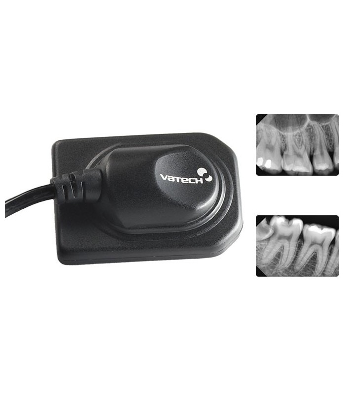 Ezsensor Clasic, cu două radiografii